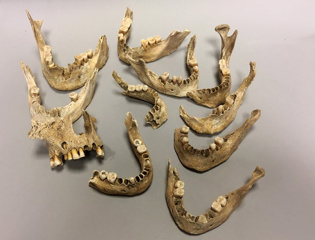 Restes de crâne et mandibules humaines, ossuraire des Gâches, collections du muséum de Toulouse