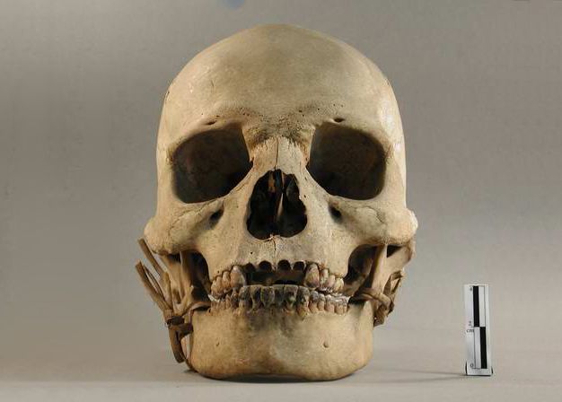 Crâne humain donné au muséum par Jean Moura, représentant du protectorat français au Cambodge de 1876 à 1877, collections du muséum de Toulouse