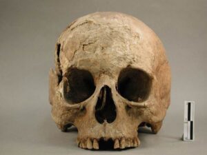 Homo sapiens sapiens, crâne, collections du muséum de Toulouse