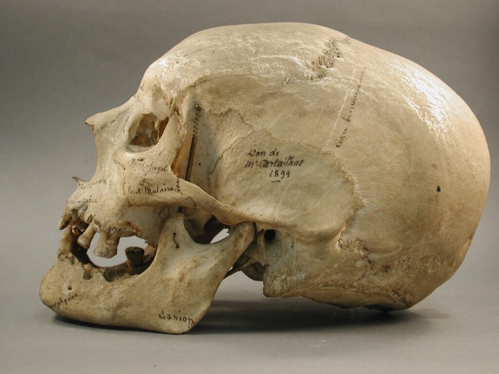 Crâne d'Homo sapiens, collections du muséum de Toulouse