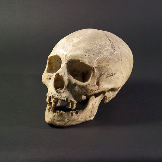 Crâne d'homo sapiens, collections du muséum de Toulouse